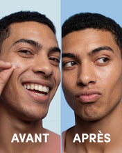 24 Clear Blemish Patches