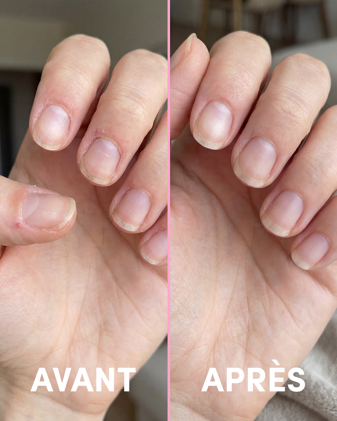 Nail and Cuticle Serum